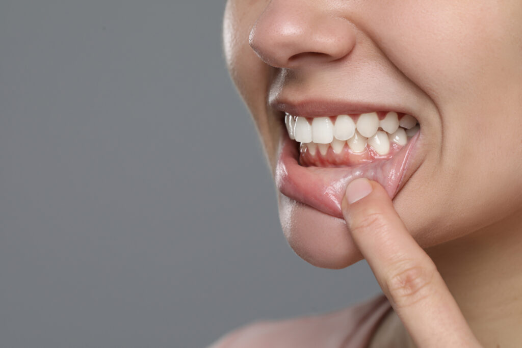 Periodoncia: ¿Qué es y cuáles son los principales tratamientos? | Clínica Lucía Trujillo