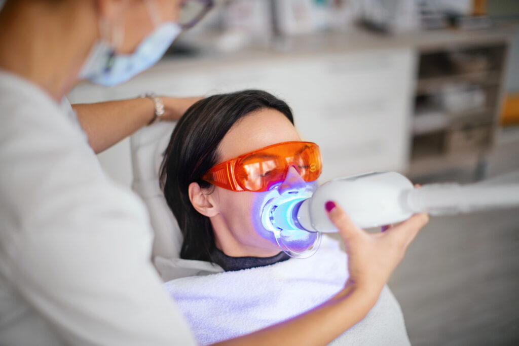 Blanqueamiento dental: cómo mantener tu sonrisa blanca por más tiempo