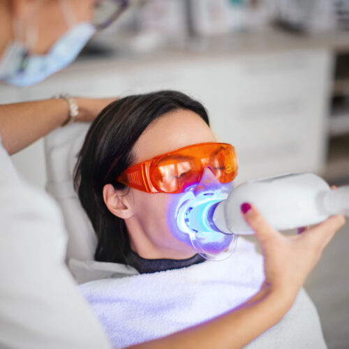 Blanqueamiento dental: cómo mantener tu sonrisa blanca por más tiempo